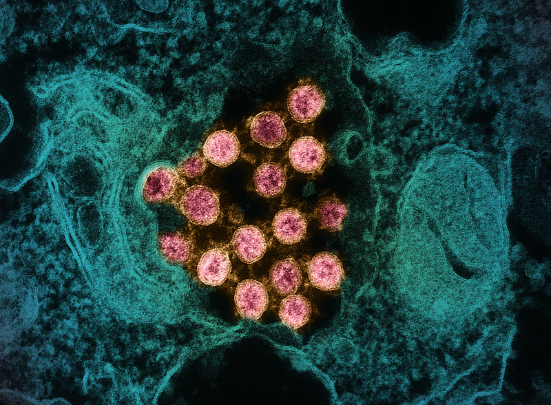 CDC tracking BA.2.87.1 SARS-CoV-2 variant | CIDRAP